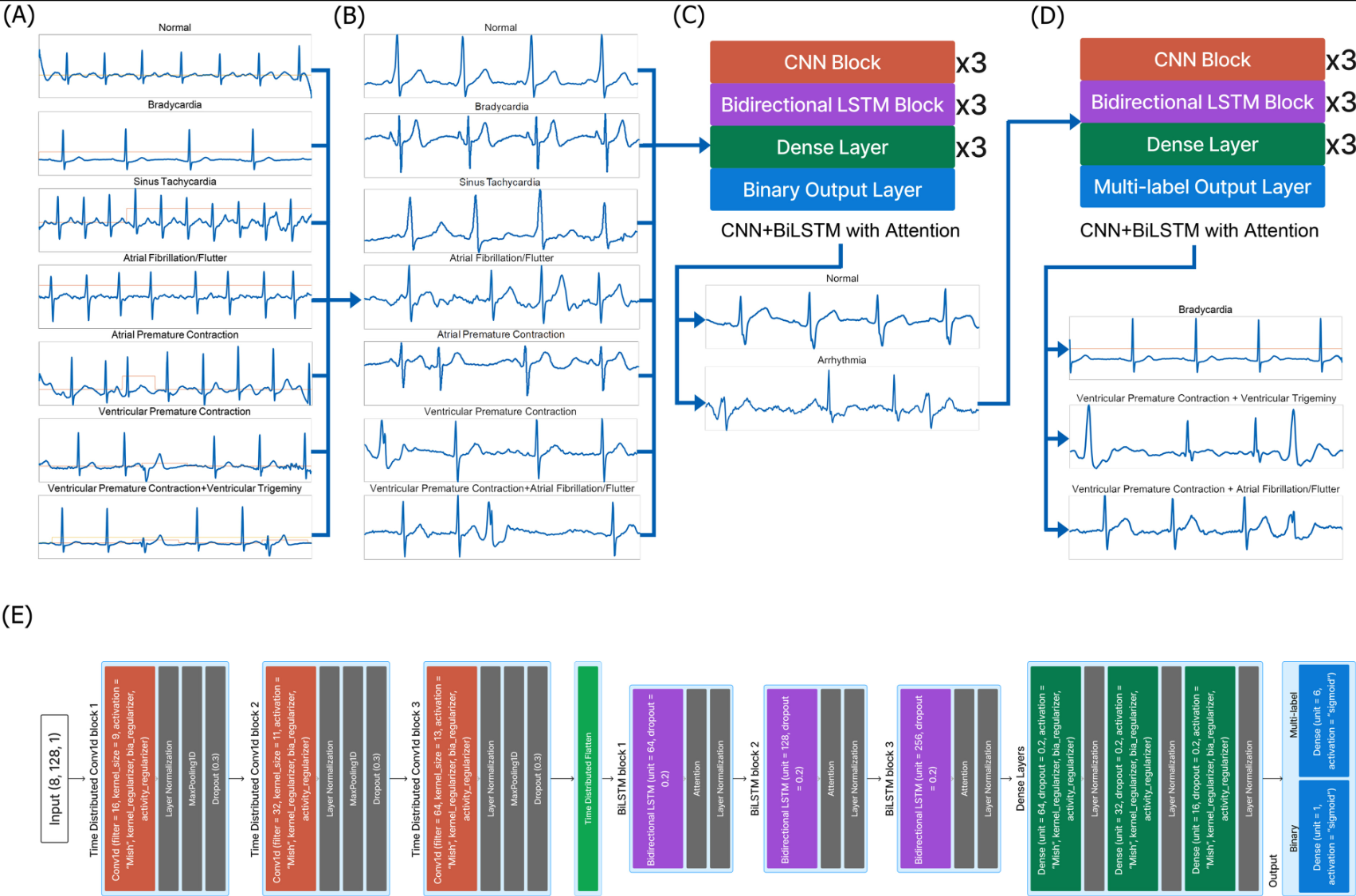 A to D is a flowchart of the proposed framework. C to D are proposed concepts of a hierarchical approach. A Multi-labeled wireless ECG arrhythmia raw data, B 4-beat input data after preprocessing, C Binary classification model for normal heartbeat and arrhythmia classification, D Multi-class, multi-label arrhythmia classification model, E Detailed structure of the proposed CNN BiLSTM with attention model.